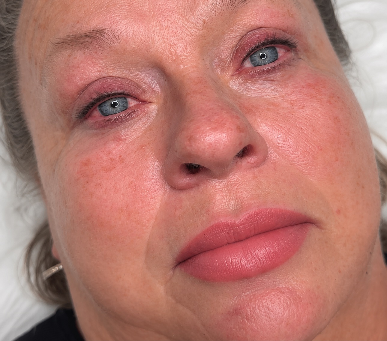 Removal-Brows